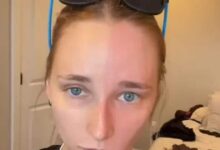 woman weird disease 2025 07 f24a2b2b3e205e098bd562127091643e 16x9