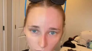 woman weird disease 2025 07 f24a2b2b3e205e098bd562127091643e 16x9