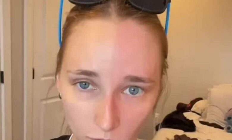 woman weird disease 2025 07 f24a2b2b3e205e098bd562127091643e 16x9